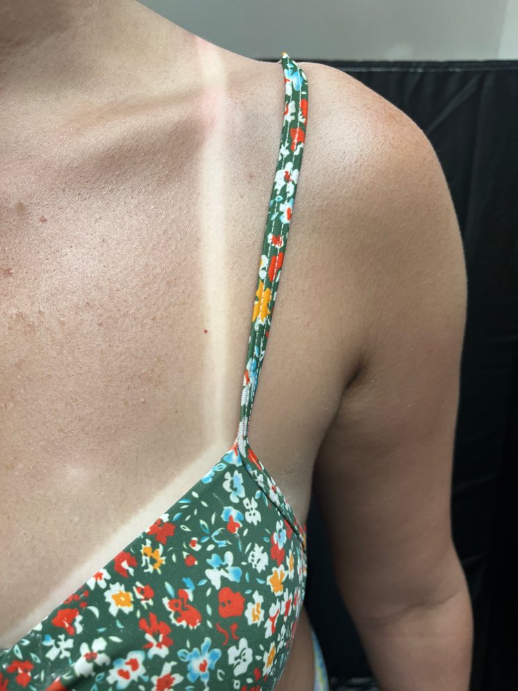Spray tan result